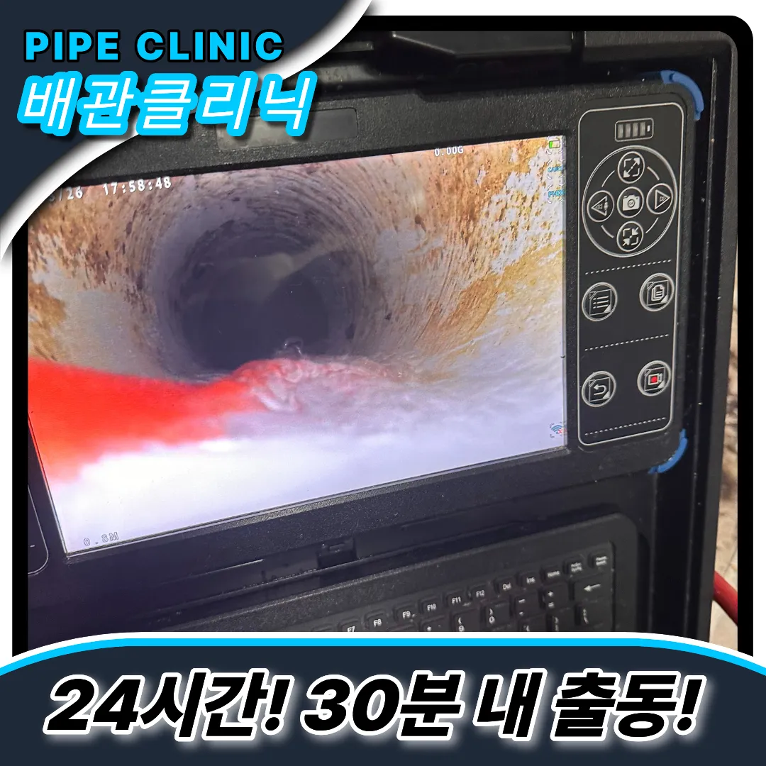 최첨단내시경보유