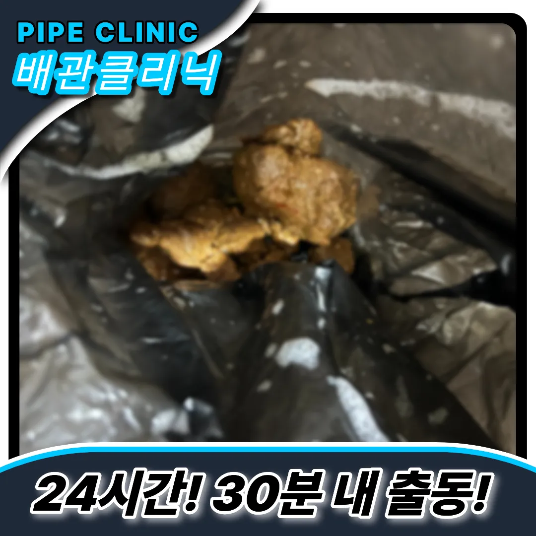 대변막힘