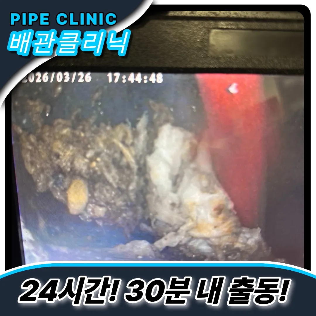 이물질제거전문
