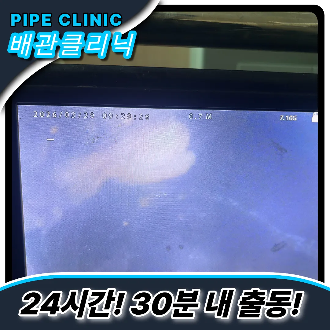 최첨단내시경