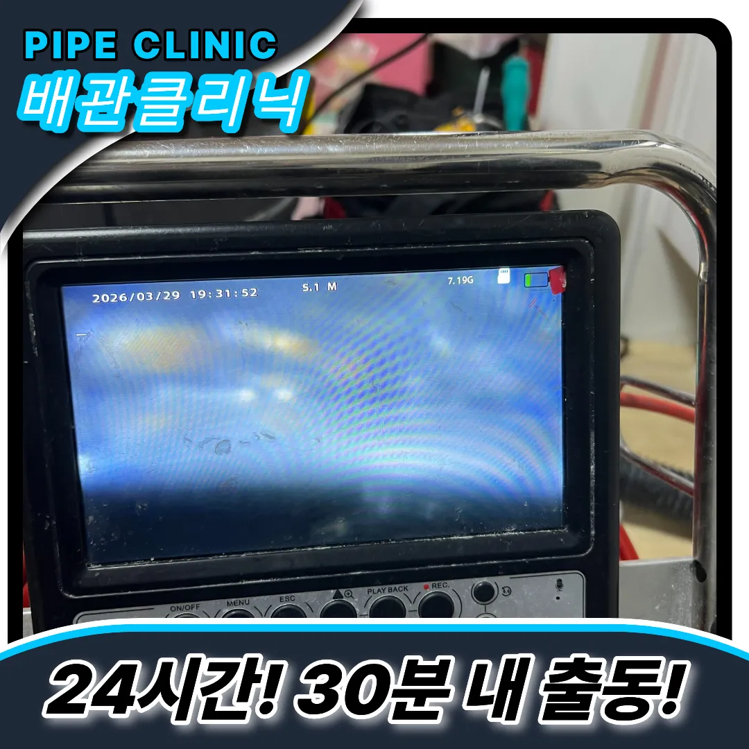 최첨단내시경