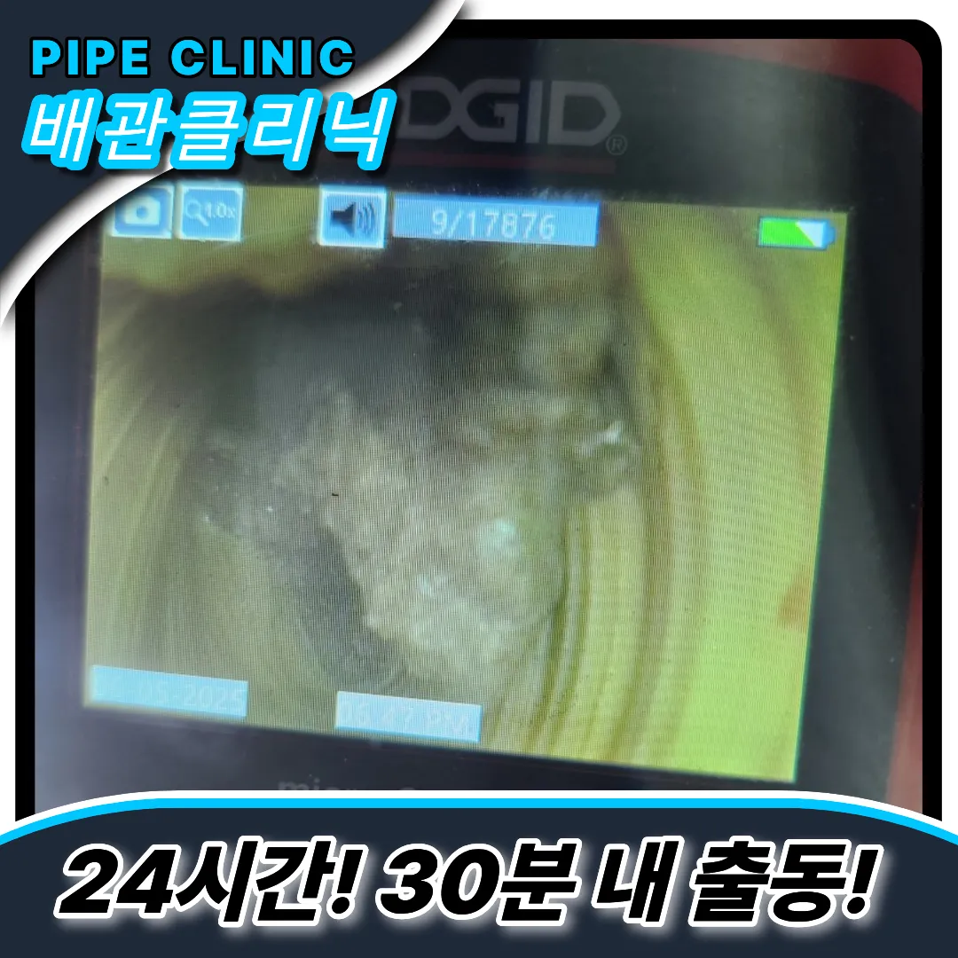 배관눌림증상
