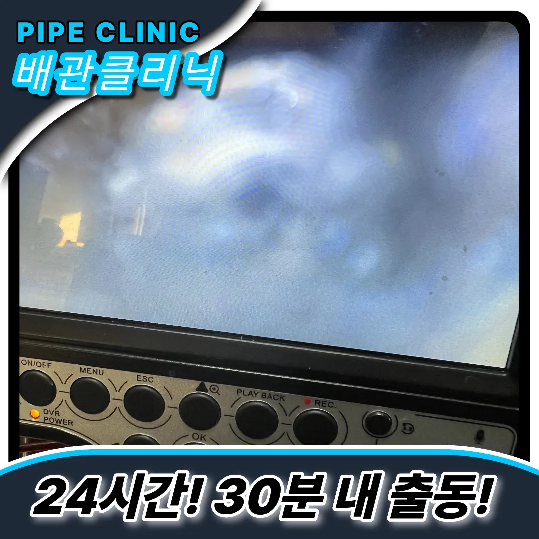 최첨단내시경