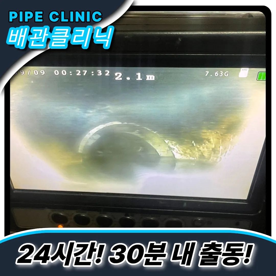 최첨단내시경
