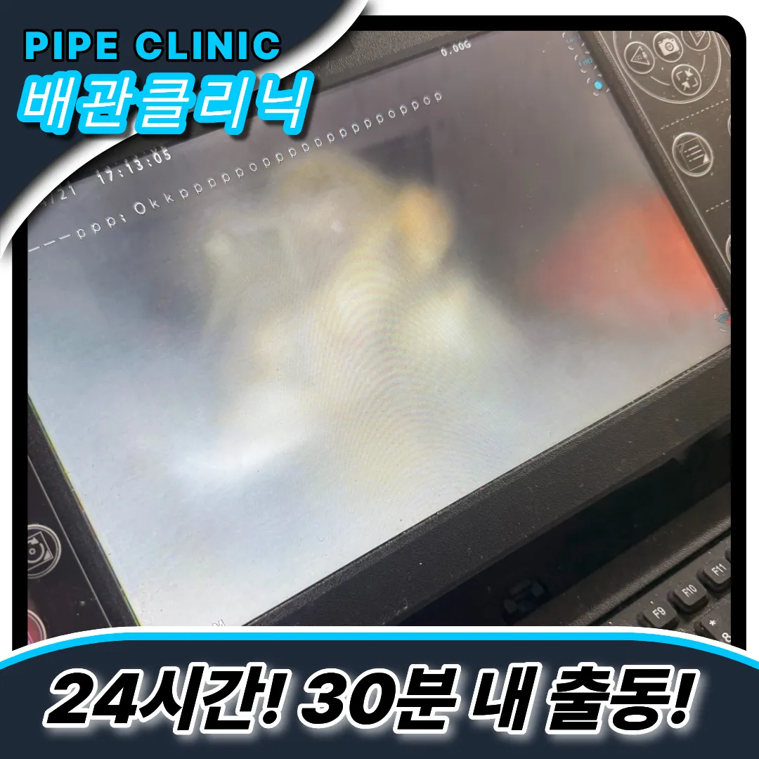 횡주관뚫는비용 style=
