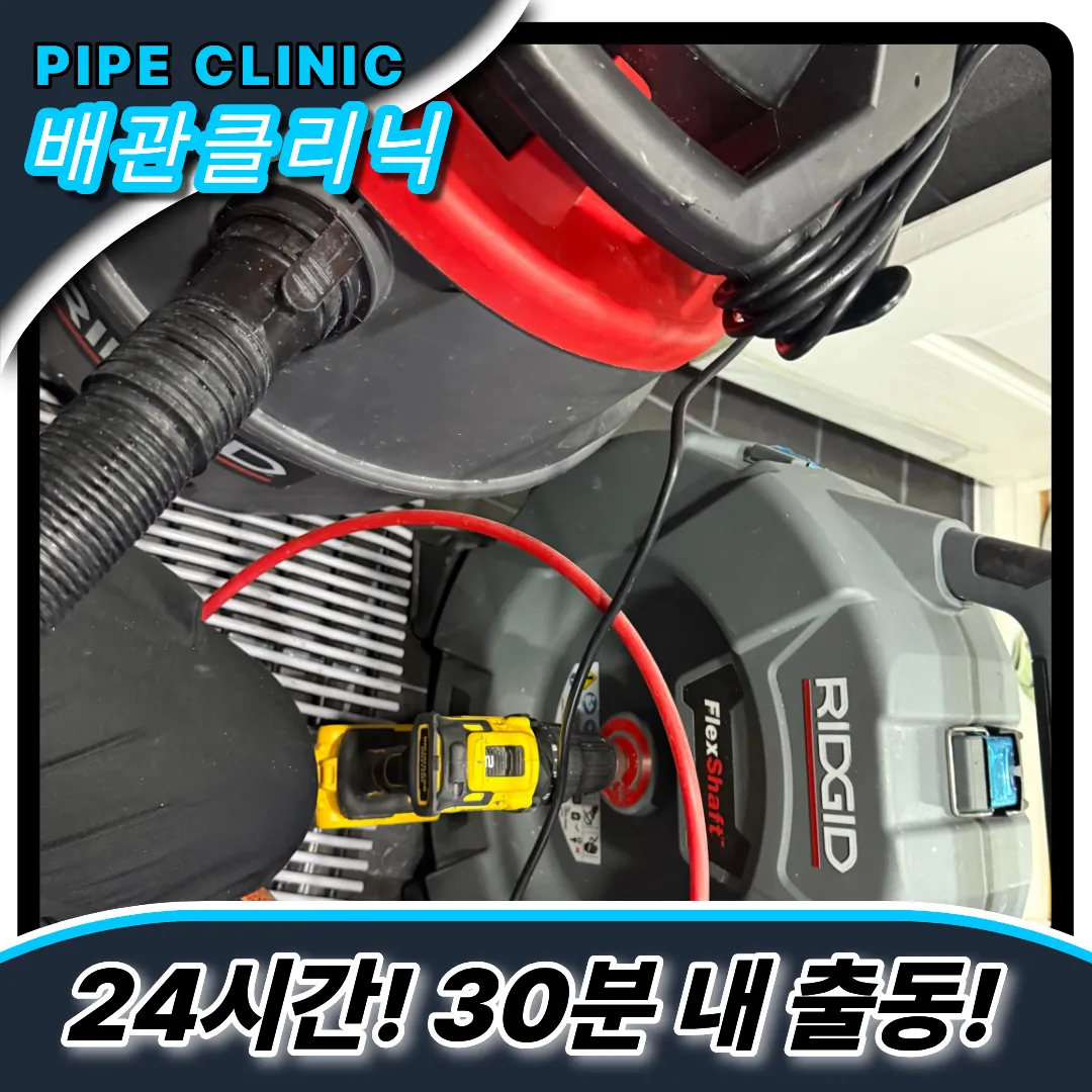 머리카락제거
