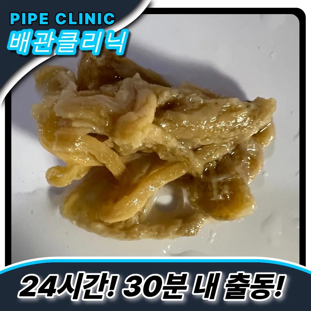 음식물제거