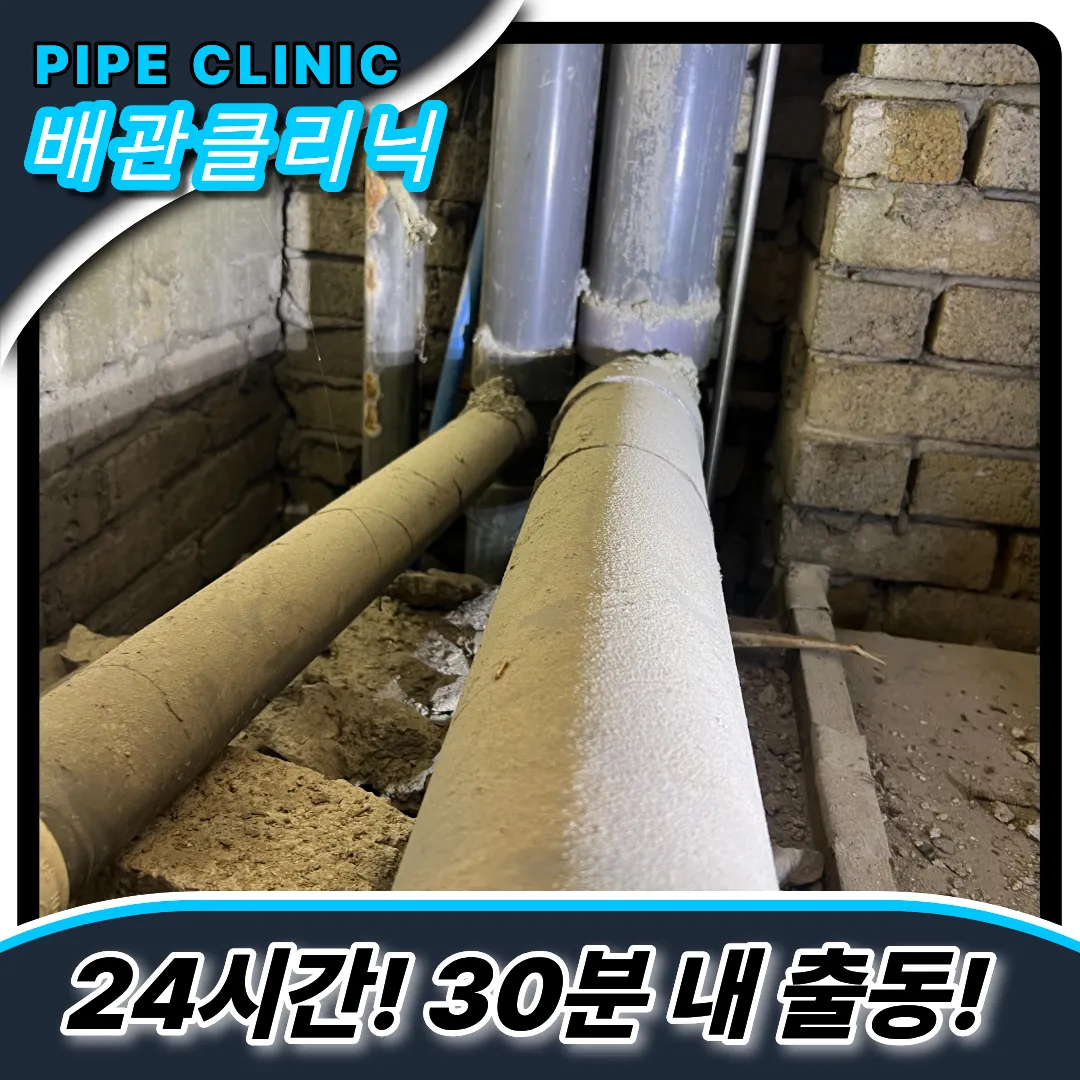 횡주관막힘
