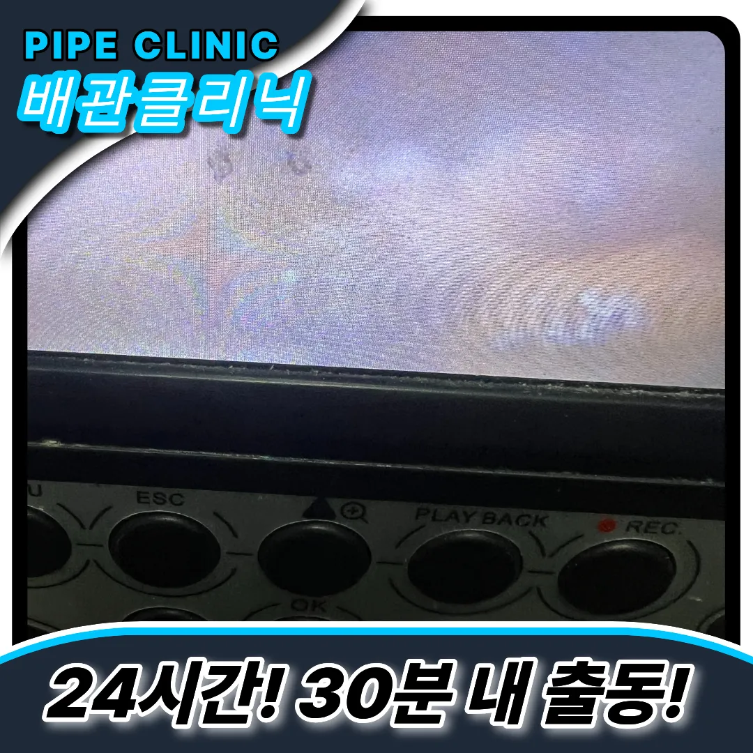 횡주관막힘
