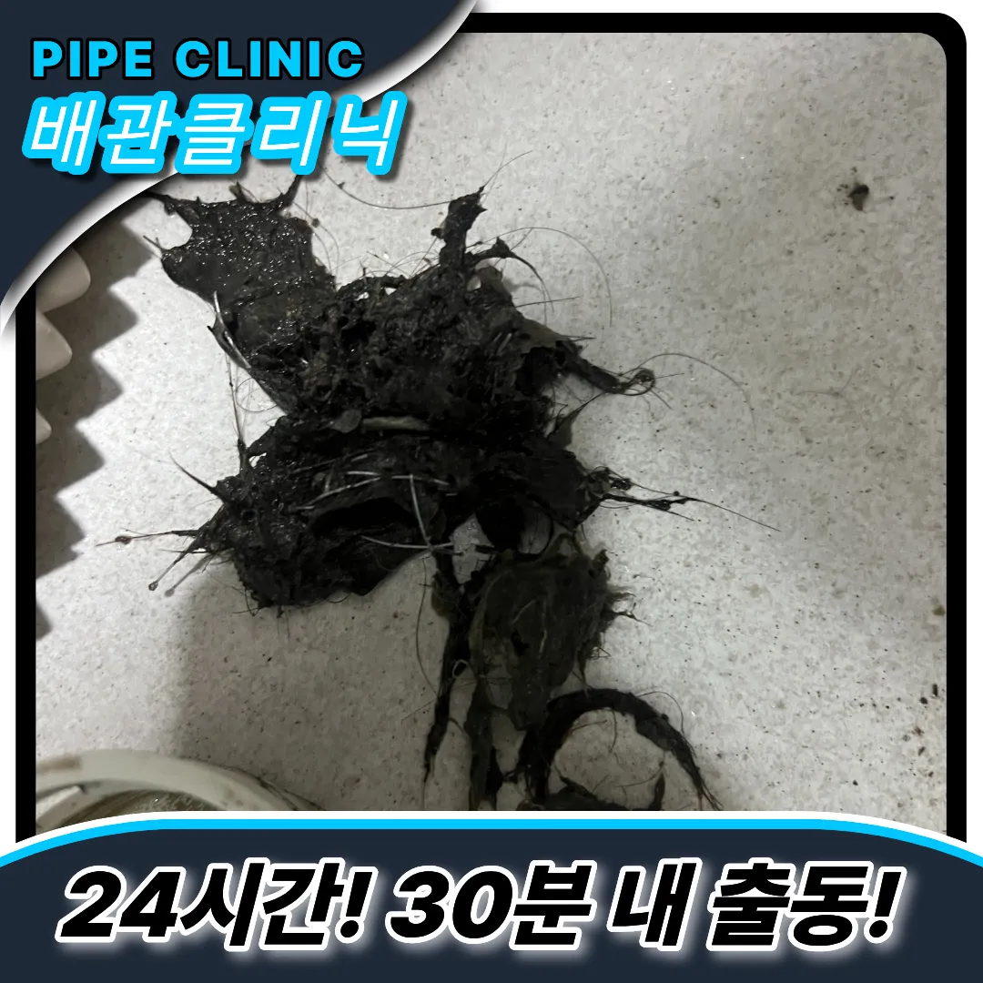 머리카락제거방법