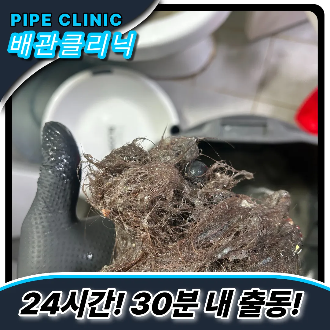 머리카락제거