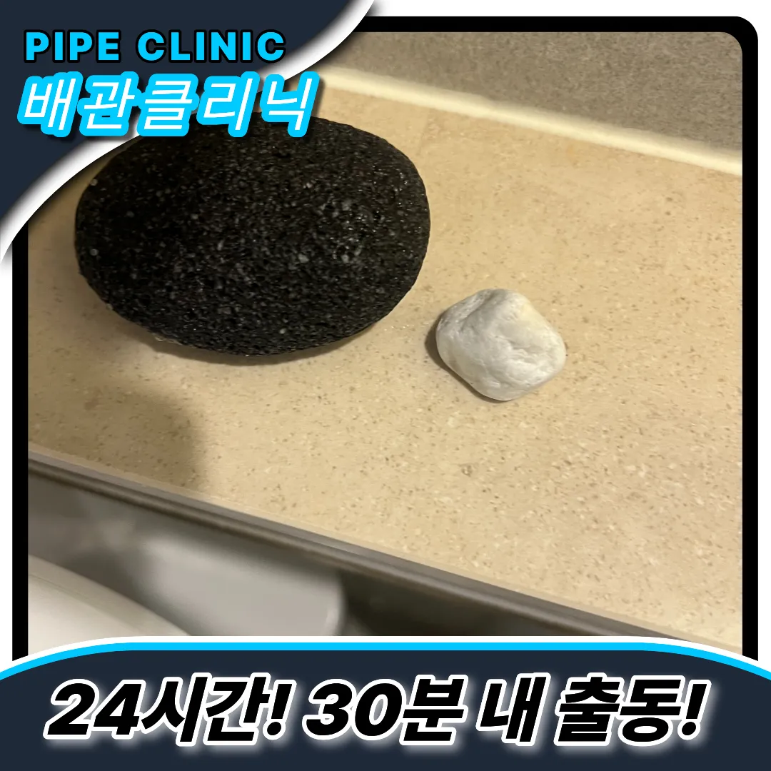 이물질제거후기