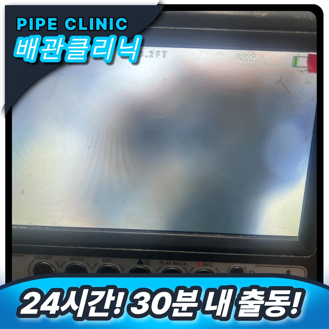 최첨단 내시경 보유