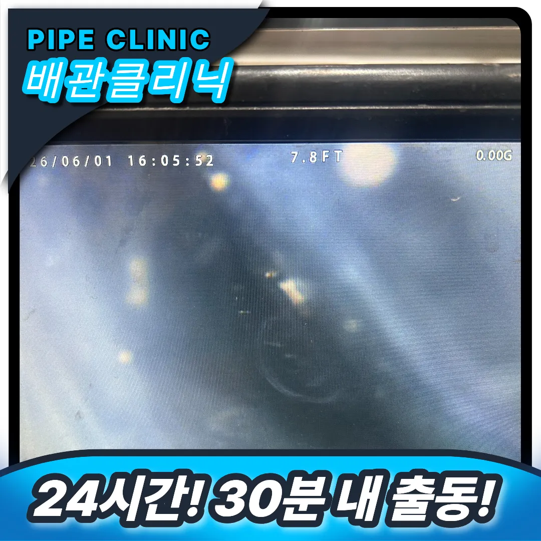고화질 내시경