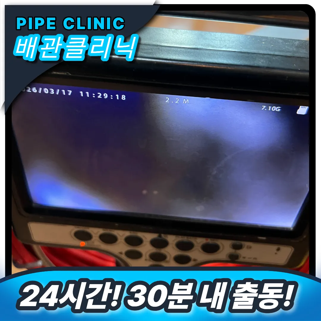 최첨단 내시경