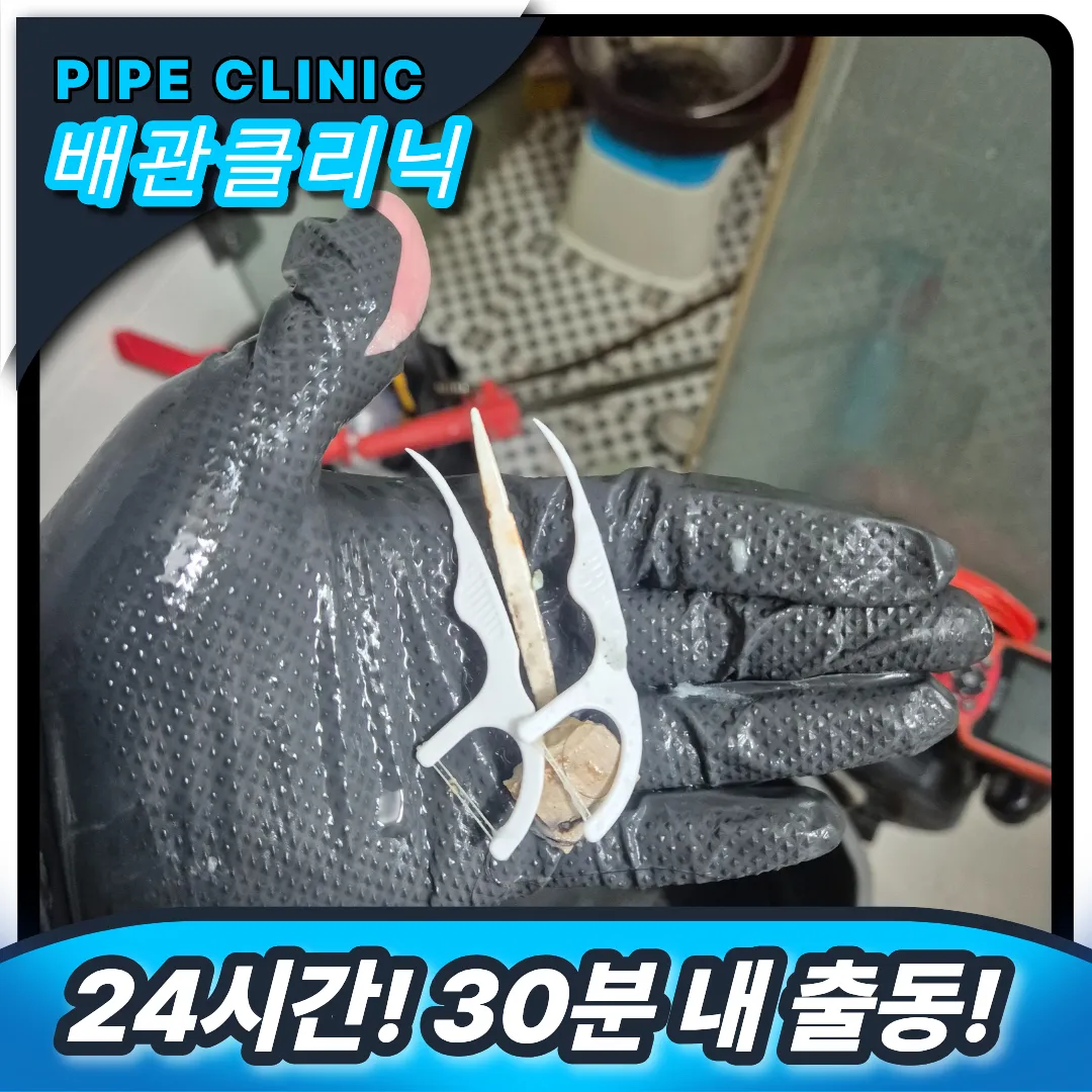 치실 제거