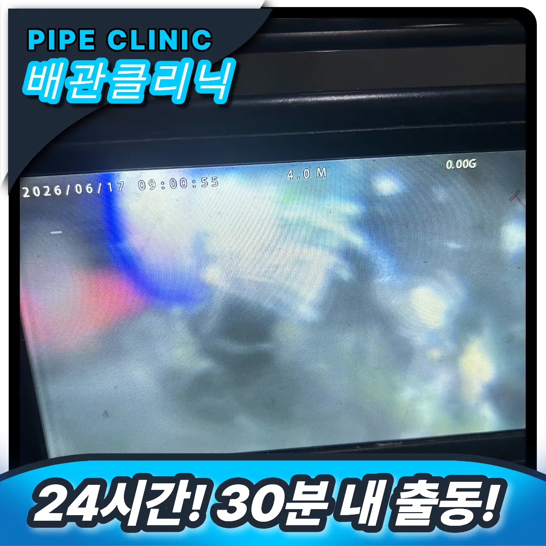내시경