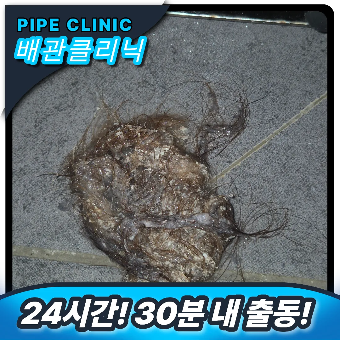 머리카락 제거