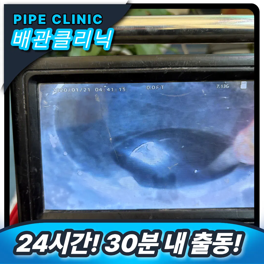 송도 횡주관막힘