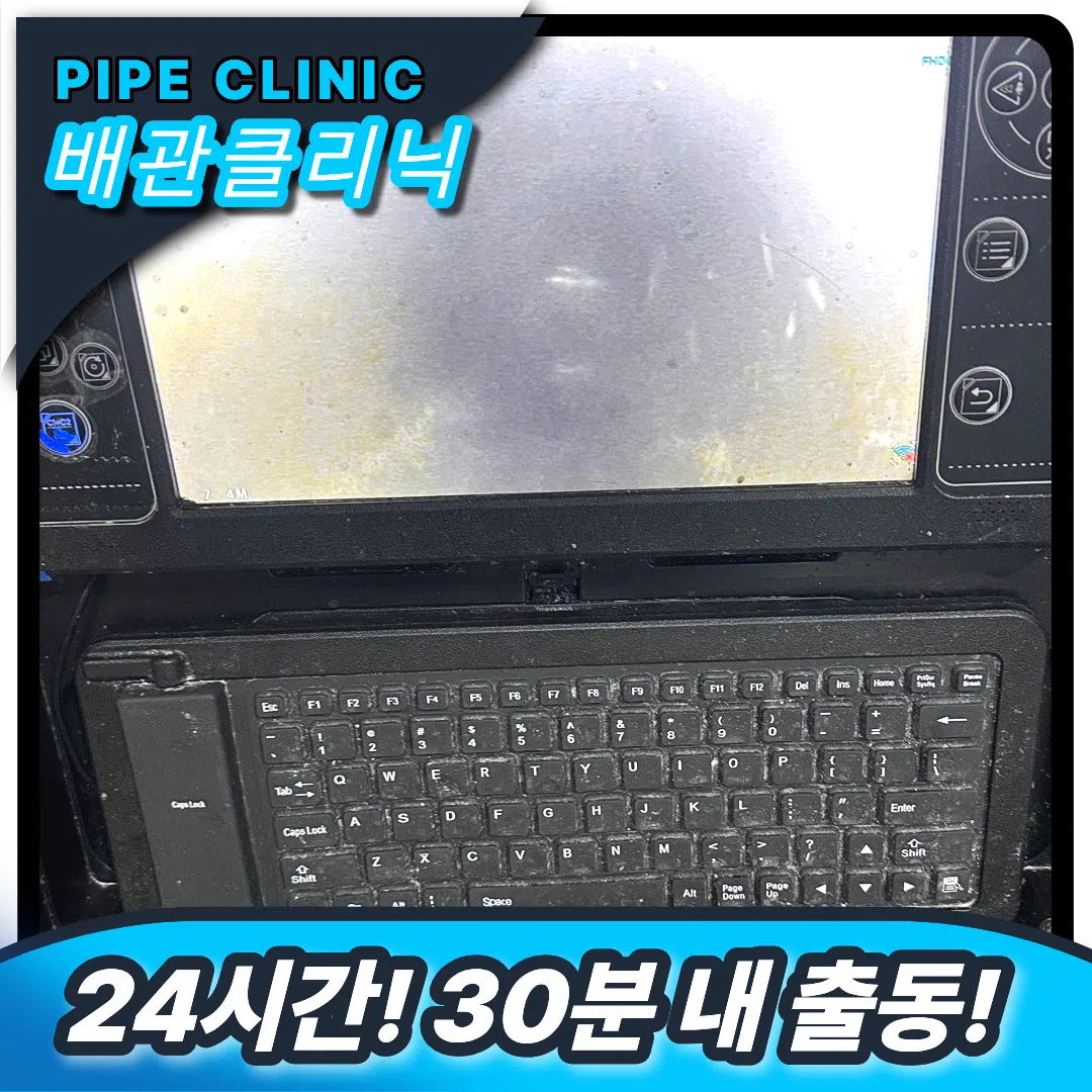 성동 횡주관막힘