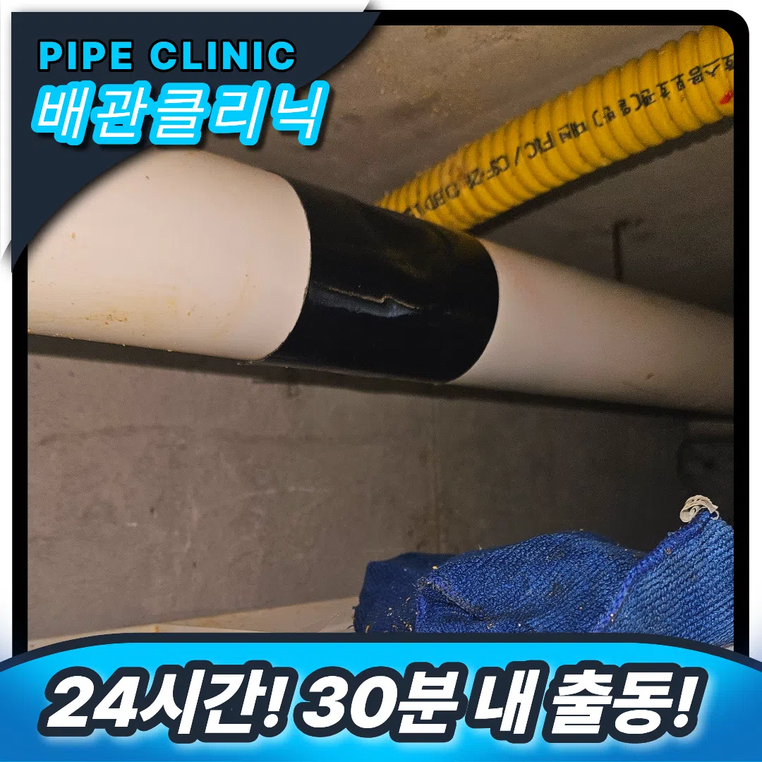 성동 횡주관막힘