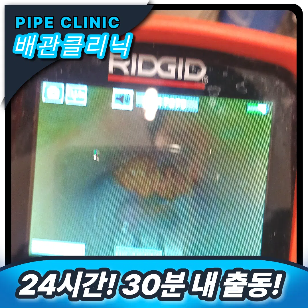 이물질 막힘
