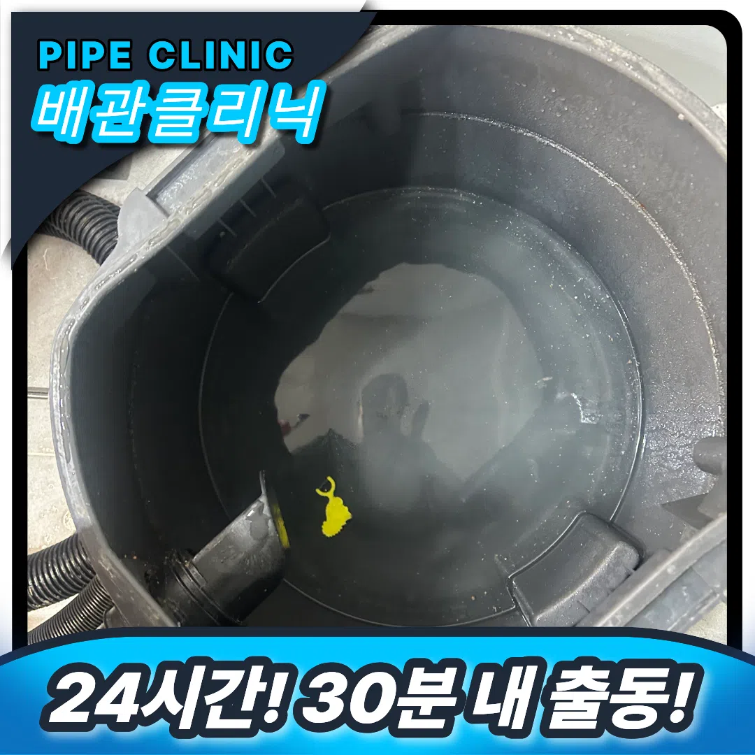 치실 제거